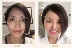 大结局#宋仲基欧巴#发红包啦！珠海科美医疗美容，你的祛痘专家