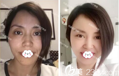 珠海科美医疗美容整形门诊部 祛痘口碑、案例、医生团队与价格优惠全解析